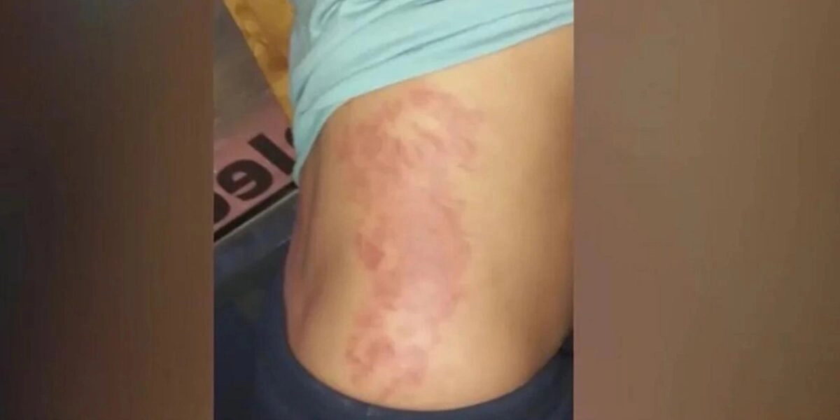 Σημάδια από ανεμώνες