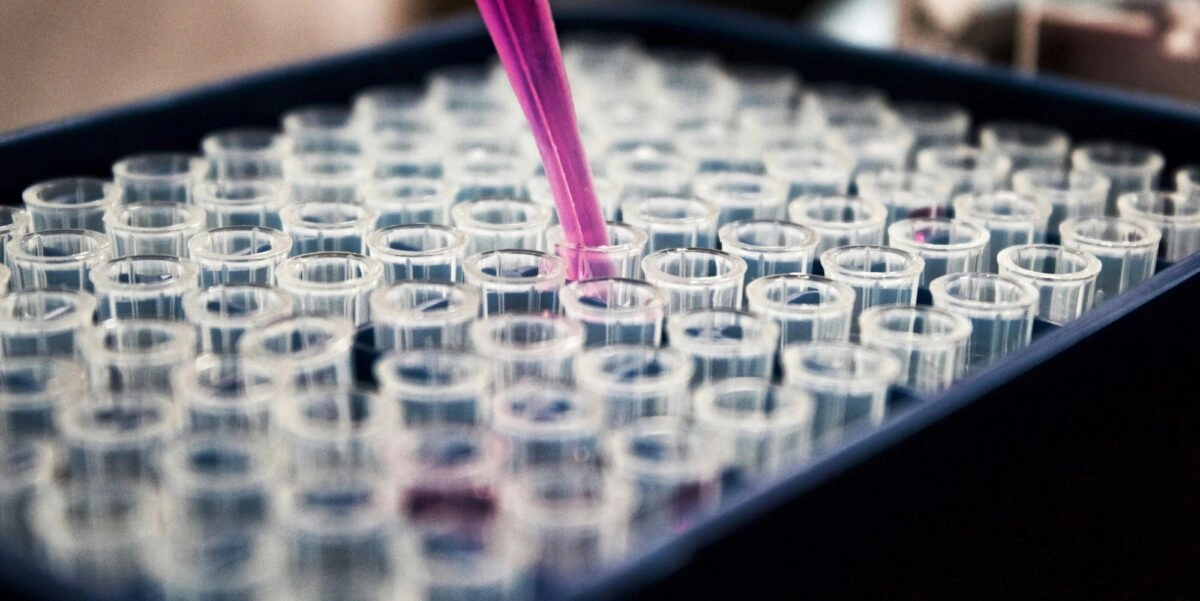 Εργαστηριακές εξετάσεις