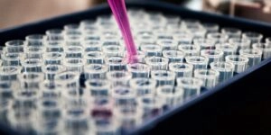 Εργαστηριακές εξετάσεις